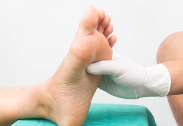 que significa llagas en los pies
