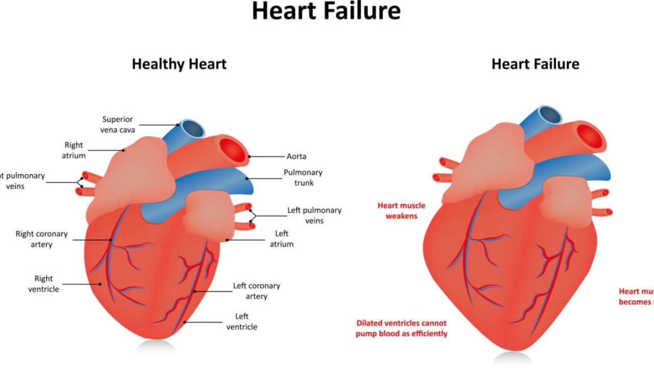 Pulmones se como los en cura liquido