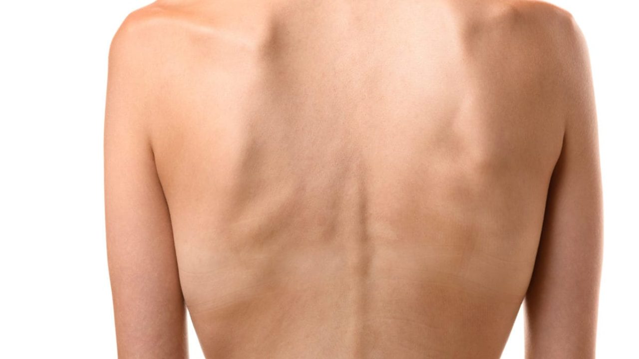 Pastillas para subir de peso rapido para hombres