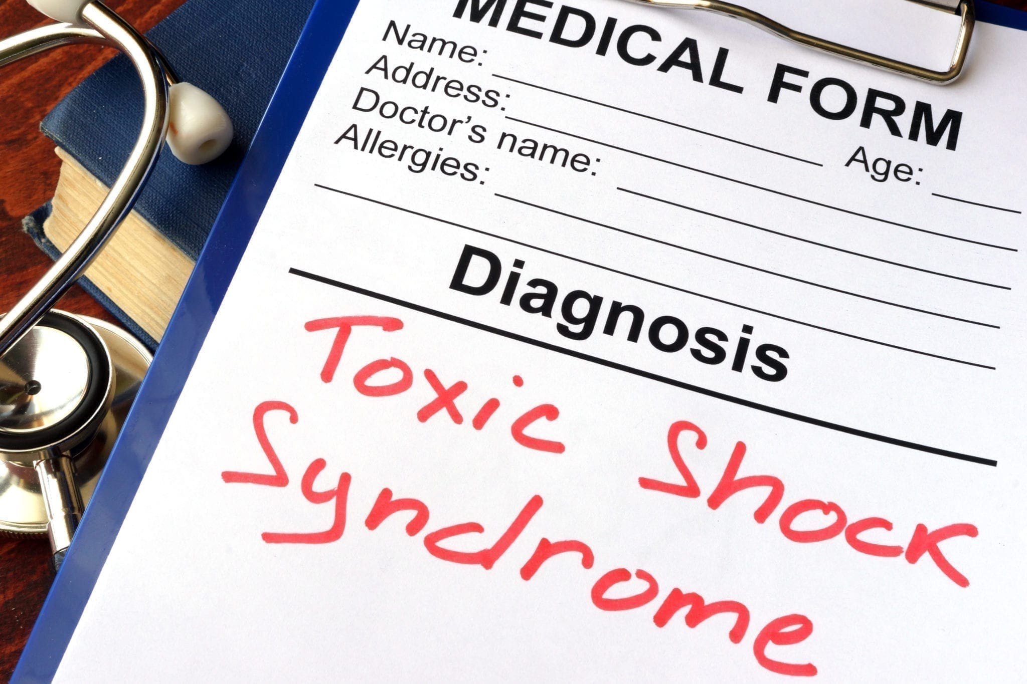 toxic-shock-syndrome-causes-signs-symptoms-treatment