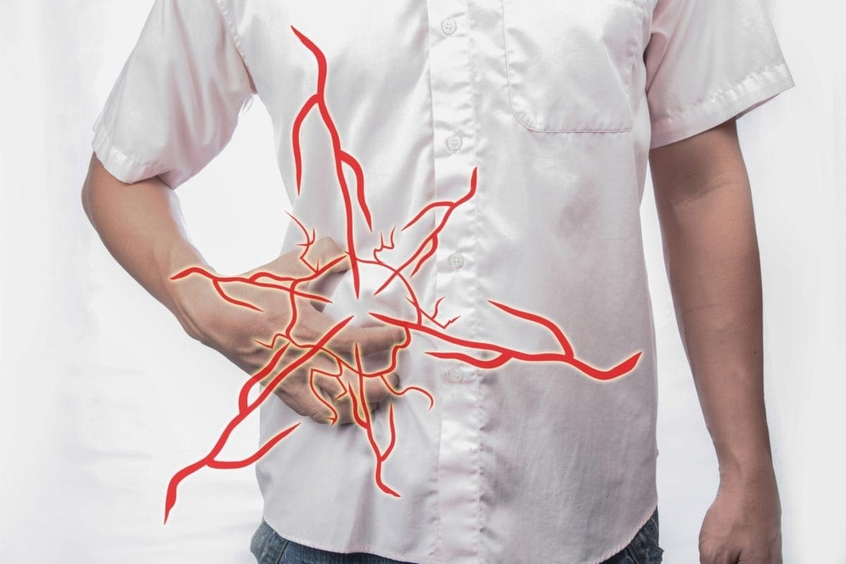 Ejercicios para corregir hernia inguinal
