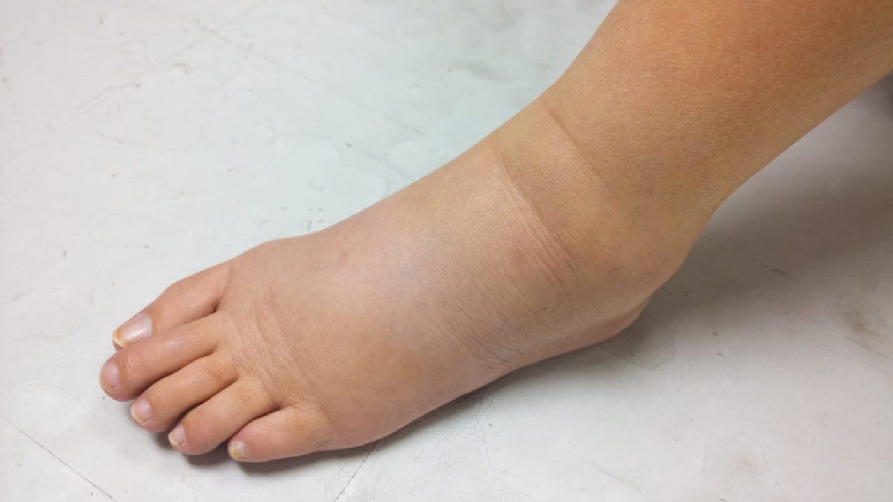 Dolor muscular en las piernas después de la gripe estomacal